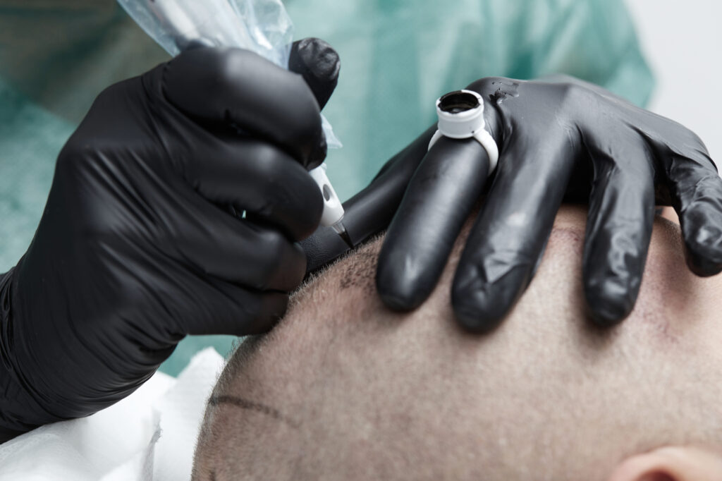 tricopigmentation bordeaux