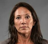 femme perte de cheveux solution